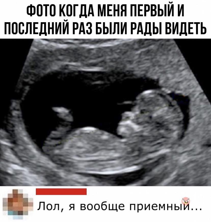 Как выглядит ребенок на 12 неделе беременности фото