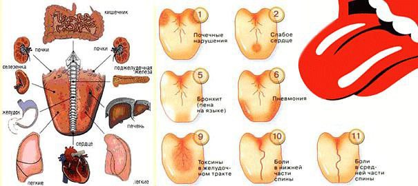 Заболевания по языку в картинках