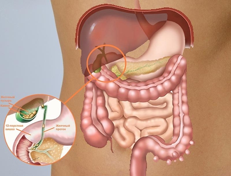 Болит толстая кишка. Желчный пузырь сигмовидная кишка. Застой желчи в желчном пузыре. Желчный пузырь и кишечник.