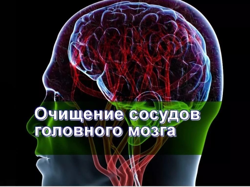 Видео сосудов головного мозга. Очищение сосудов головного. Чистка сосудов головного мозга. Средства для чистки сосудов головного мозга.