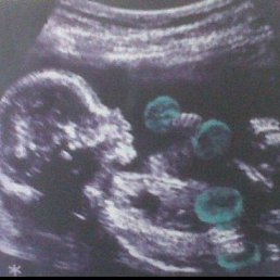 ���� ������, ������ - ��������� 31 ������ 2013