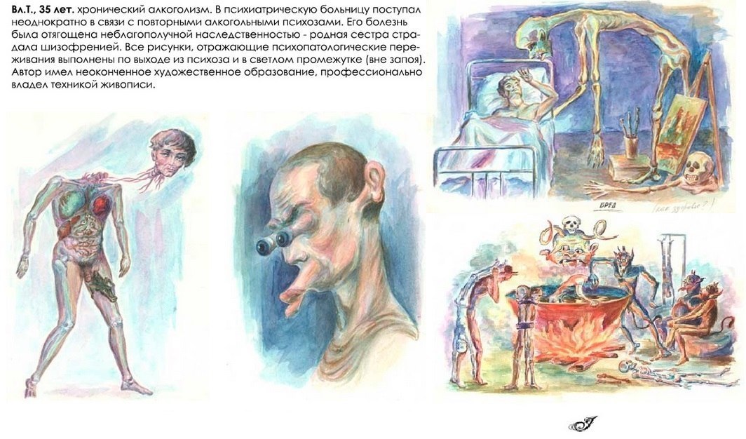 Рисунок психически больных людей