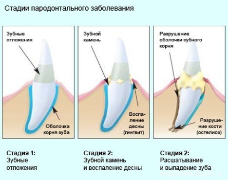 Неприятный запах изо рта у собак. Неприятный запах изо рта у собаки является признаком различных ... - 3