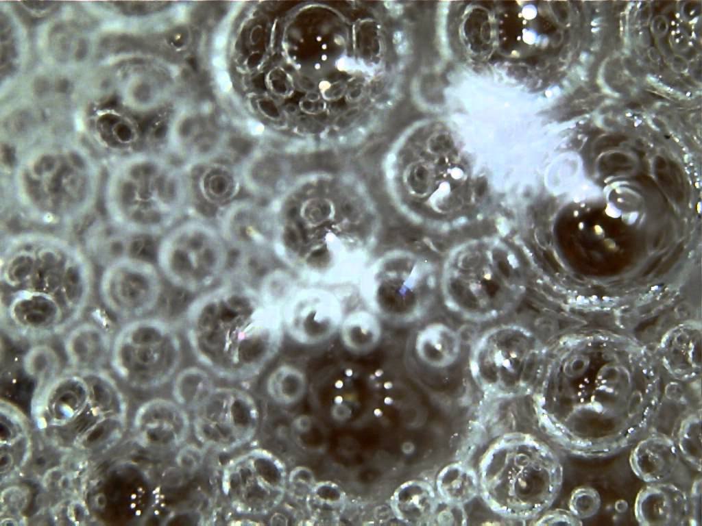 Почему пенится слюна. Слюна под микроскопом. Слюни под микроскопом. Слюна человека под микроскопом. Препарат слюны под микроскопом.