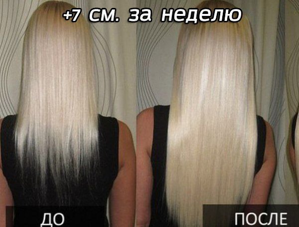 ВОЛОСЫ РАСТУТ КАК ДИКИЕ!!! НЕ УСПЕВАЮ СТРИЧЬ!!! Девочки, не могу не поделиться своей радостью!!! ...