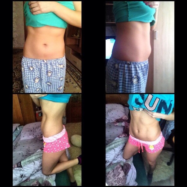        ViaFit 