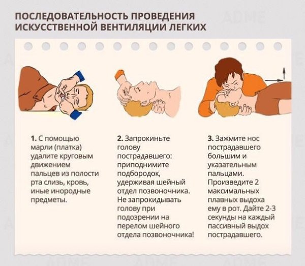 Правила оказания первой медицинской помощи Забираем себе очень важно, может спасти жизнь! Экстренные ... - 5
