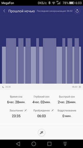 !   !   XIAOMI MI BAND 2 https://fotostrana.ru/away?to=/sl/jcq3  ...