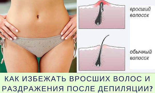 Моя история, в конце сюрприз).Всем привет! Хочу рассказать мою удивительную историю, сама бы не ...