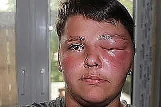 Увеличение губ, ягодиц, груди. Без операции. НЕДОРОГО! Пчеловод Василий. - 4