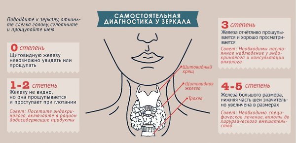 Щитовидная железа: симптомы гипотиреоза и гипертиреоза. Нарушениями в работе «щитовидки» страдает до ... - 2
