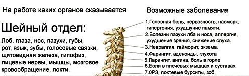 УПРАЖНЕНИЯ ПРОТИВ ГОЛОВОКРУЖЕНИЙ ПРИ ШЕЙНОМ ОСТЕОХОНДРОЗЕ. Головокружению подвержены многие пожилые ...