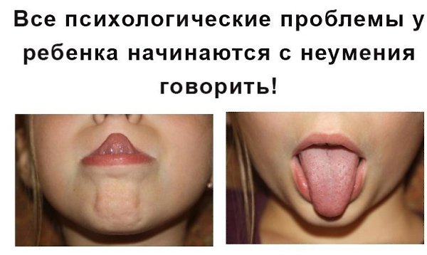 У ребенка есть проблемы с речью? Значит проблемы будут и в социуме. Прочтите, как развитие речи ...
