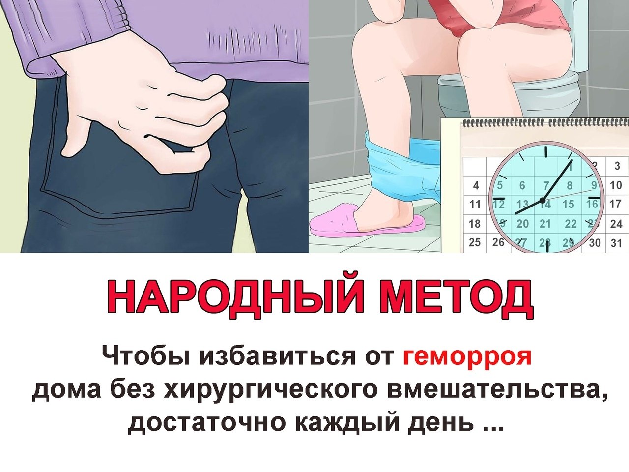 Как убрать геморроидальные узлы. Рецидив геморроя после лигирования. Как избавиться от геморроя домашними средствами. Средства от геморроя народные средства. Крем против геморроя.