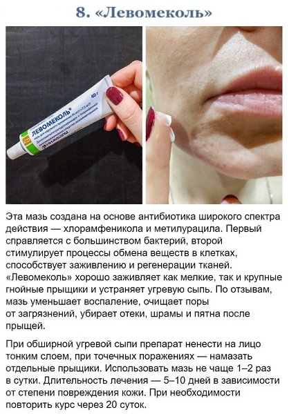 Эти аптечные cредства продлят вашу молодость в несколько раз=) - 8