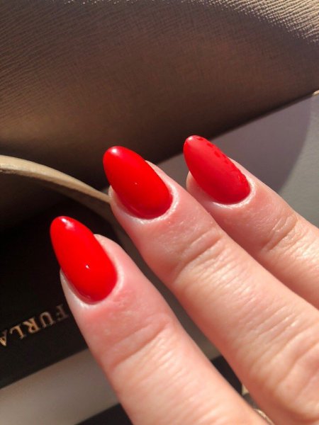 #Истории@modnailru. Девочки подскажите что делать..?? Появился жуткий зуд и мелкие водянистые ... - 2