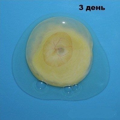      - 2