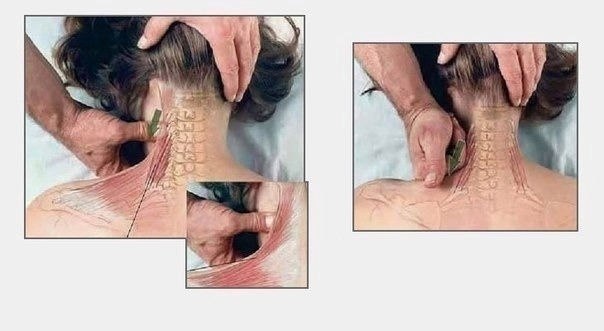 ��� ��������� ������ ������: ��������� ������� ��� ������������� - 3