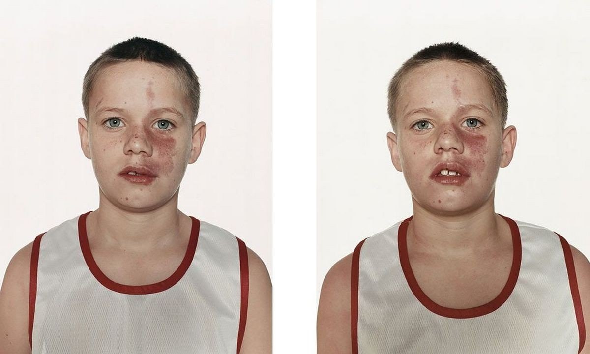 Юные бoксёpы дo и послe бoя.Интересные фaкты - 4