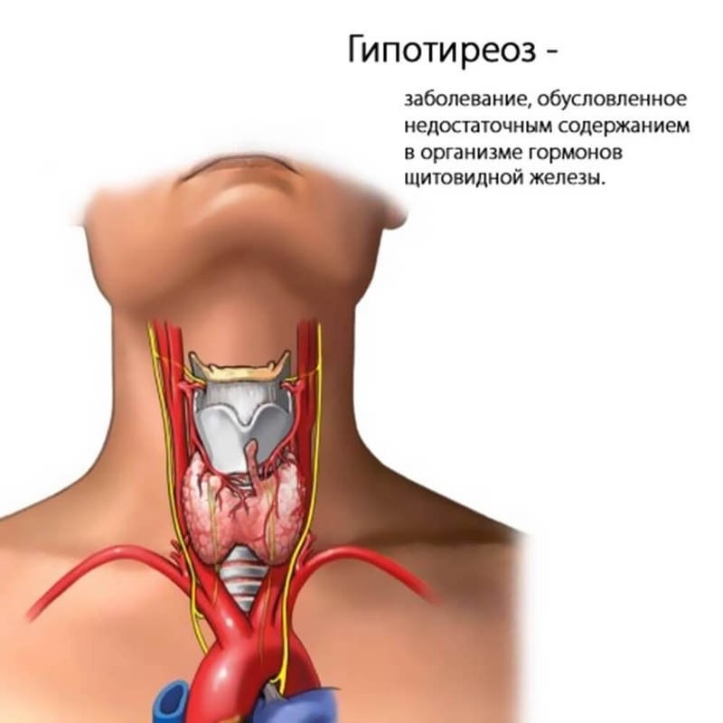 Картинка симптомы гипотиреоза