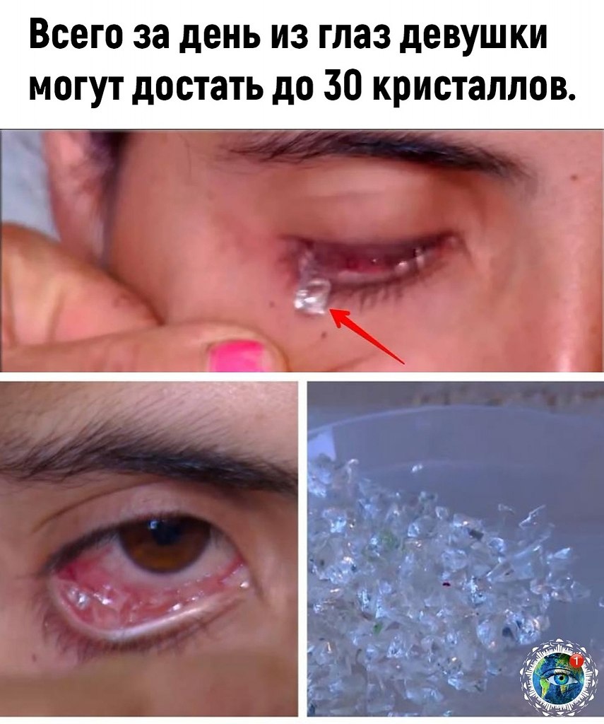 e pe ca. - 2