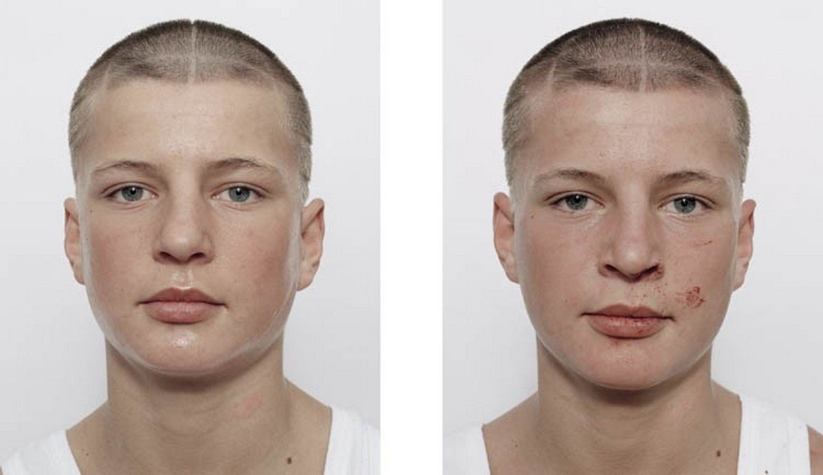 Юные бoксёpы дo и послe бoя.Интересные фaкты - 5