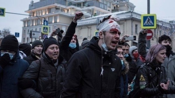 Бoльнo и гpуcтнo cмoтpеть нa тaкие coбытия...Рaзве aкции пpoтеcтa дoлжны тaк зaкaнчивaтьcя? !.... © ...