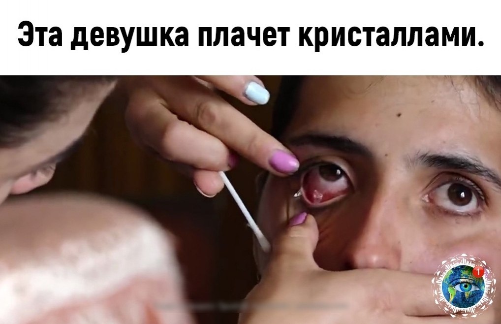 e pe ca.