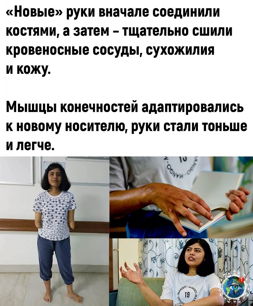 ae eo eo.  - 3