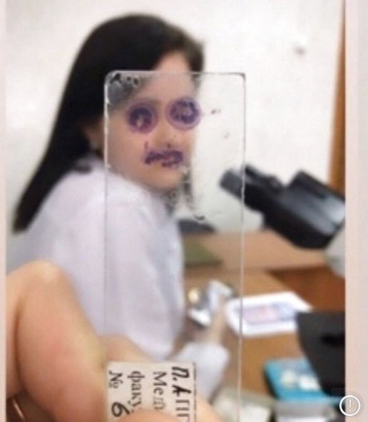    - 3