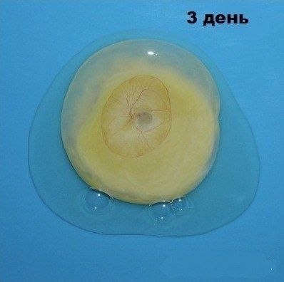    - 2