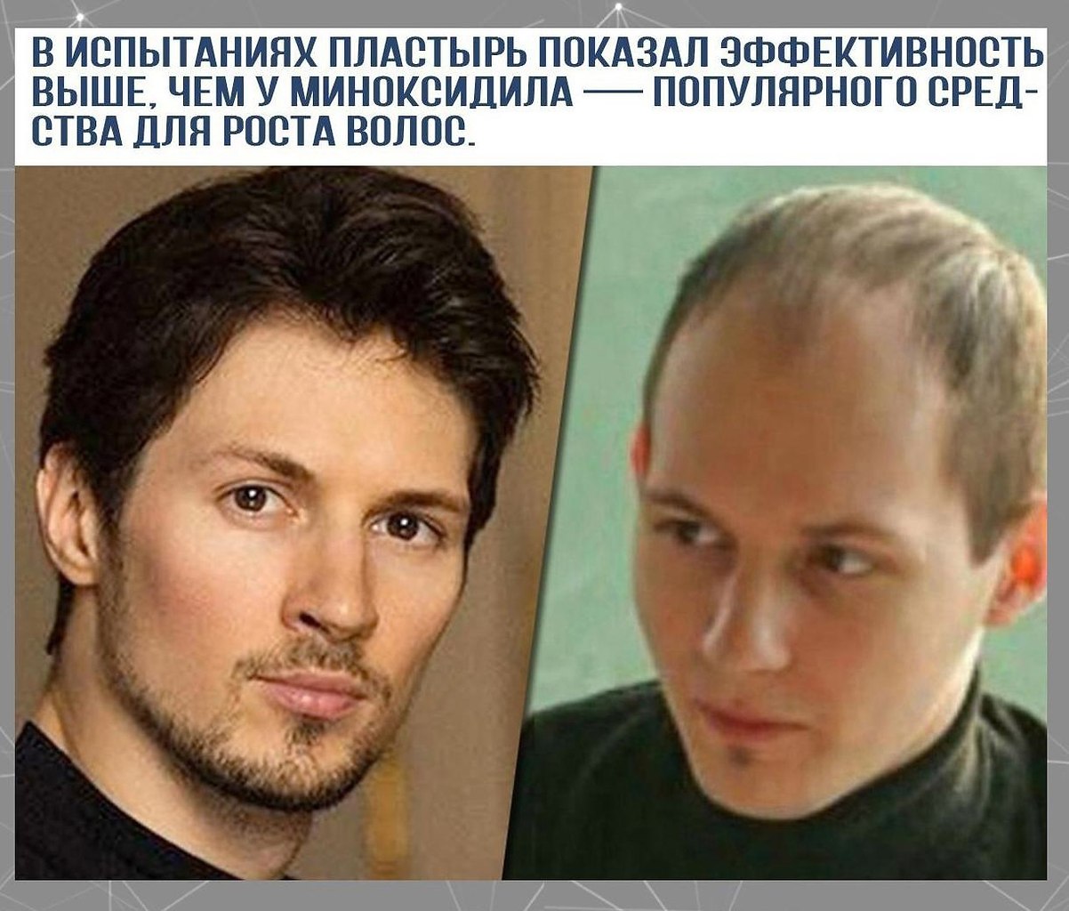 Облысение – не приговор.Потенциал! - 3