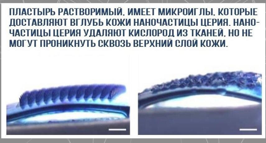 Облысение – не приговор.Потенциал! - 2