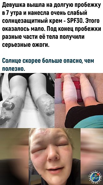 e ocopo.