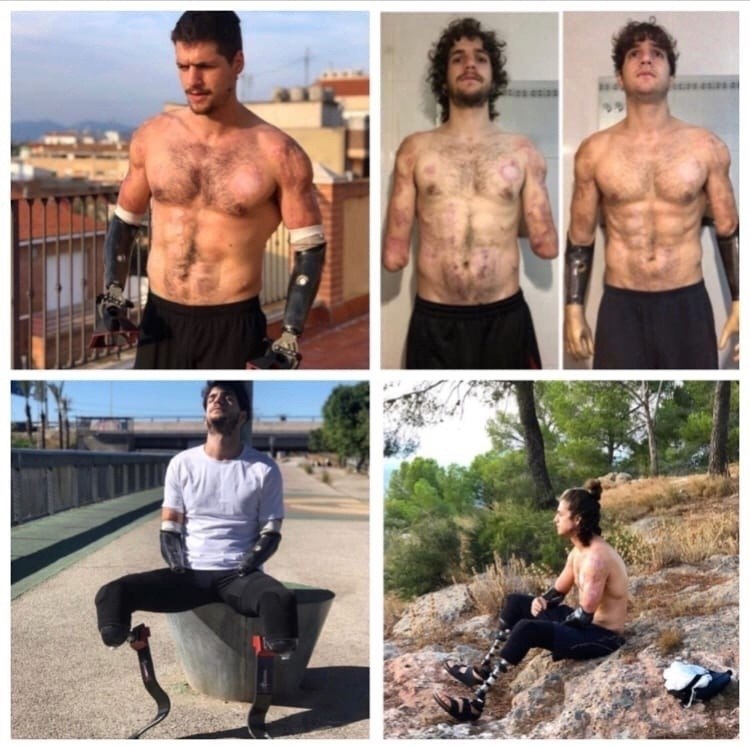   .# #