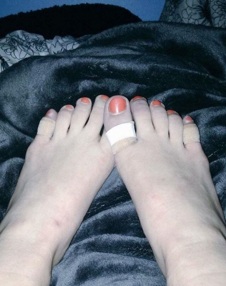      - 5