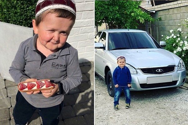 На вид ему лет 5, но уже пошел 20-ый, однако по всем внешним признакам мужчина похож на ребенка. ... - 4