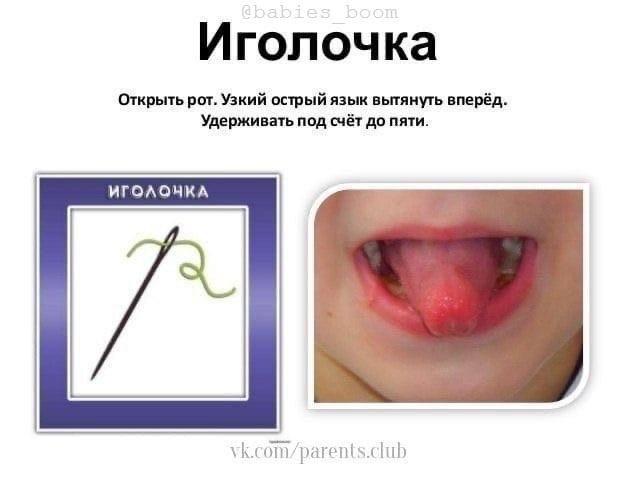   - 3