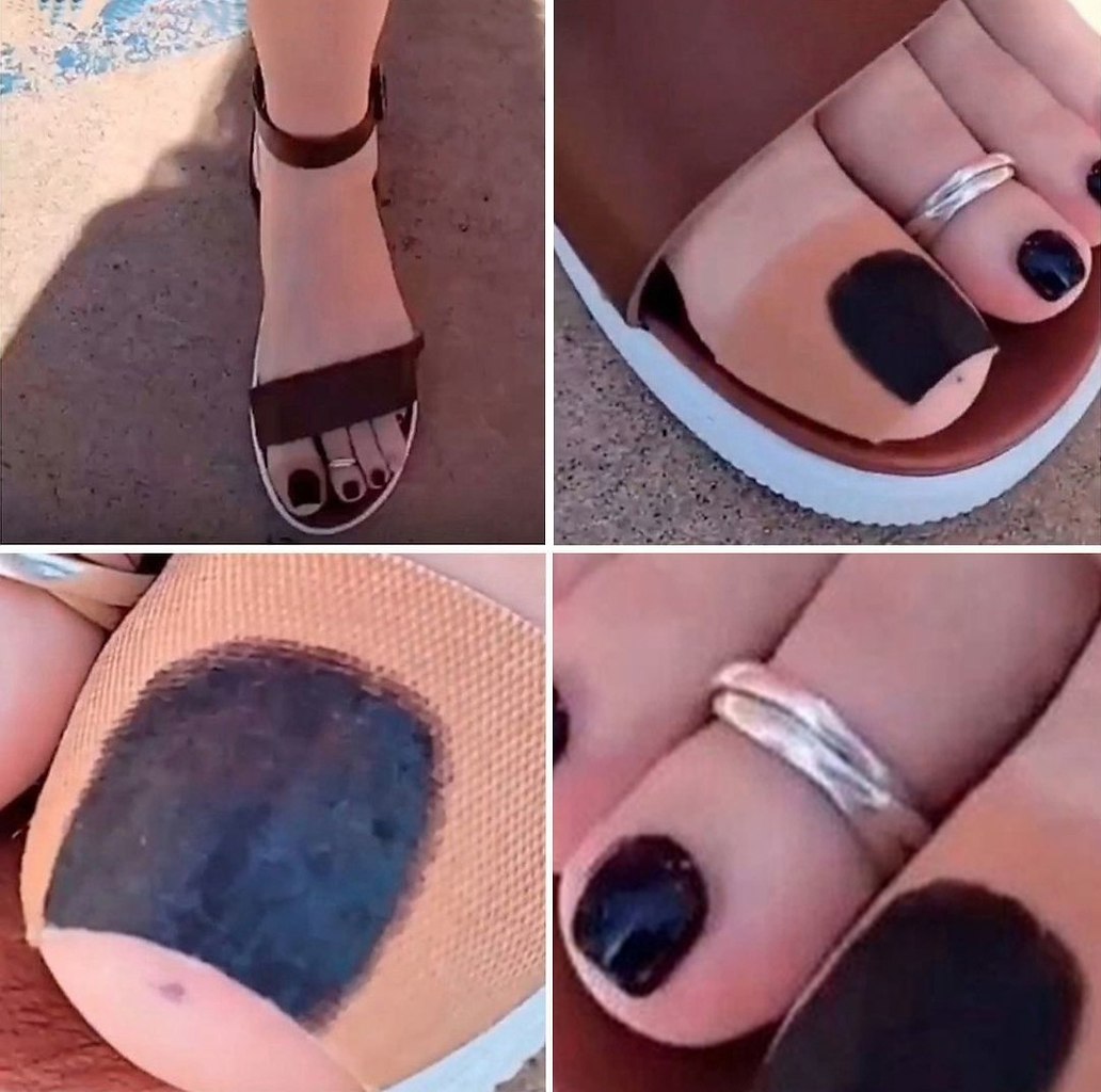  : 