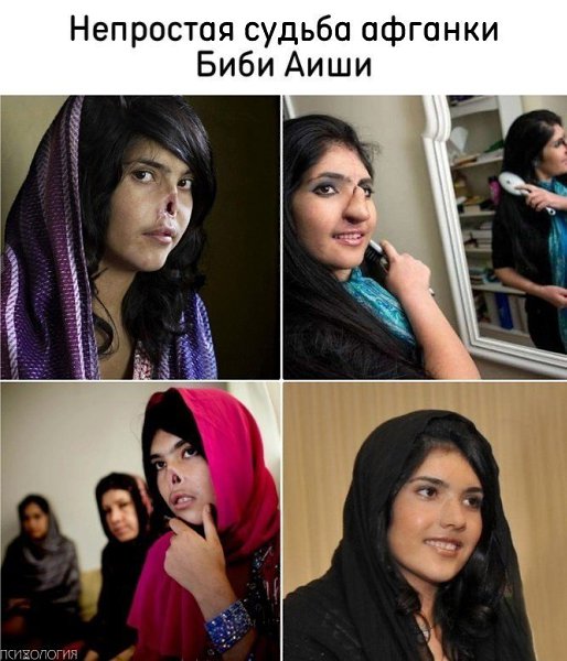 Непростая судьба девушки Биби Аиши.18-летняя Биби Аиша вышла замуж в 14 лет, после чего спустя время ...