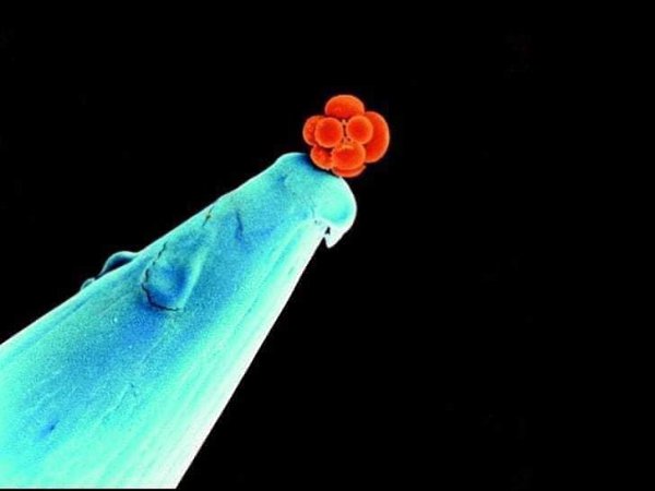 :) На данном фото изображен эмбрион человека на кончике иглы в возрасте трех дней. Сейчас он состоит ...