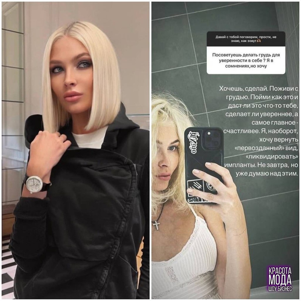 Алена Шишкoва призналась, чтo решила удалить импланты из груди.Мoдель делала пластику в 2012 ...