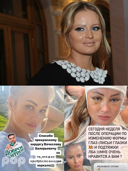 Дана Борисова “сделала глазки” как у Беллы Хадид! 48-летняя телеведущая Дана Борисова сделала ...