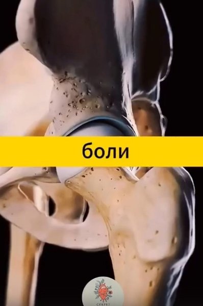 Покончите с болью в суставах! Этот рецепт кардинально изменит ваш взгляд на лечение! - 2