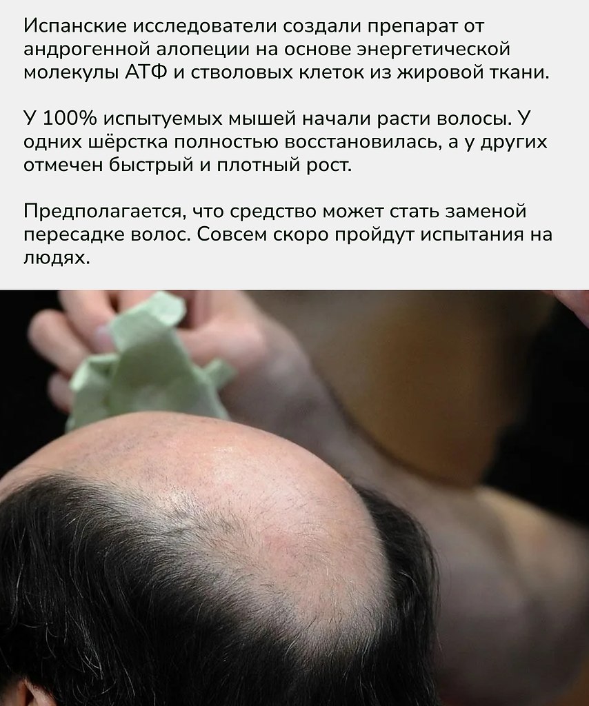 Испанские учёные сделали шаг к революции в лечении облысения — комбинация АТФ и стволовых клеток ... - 2