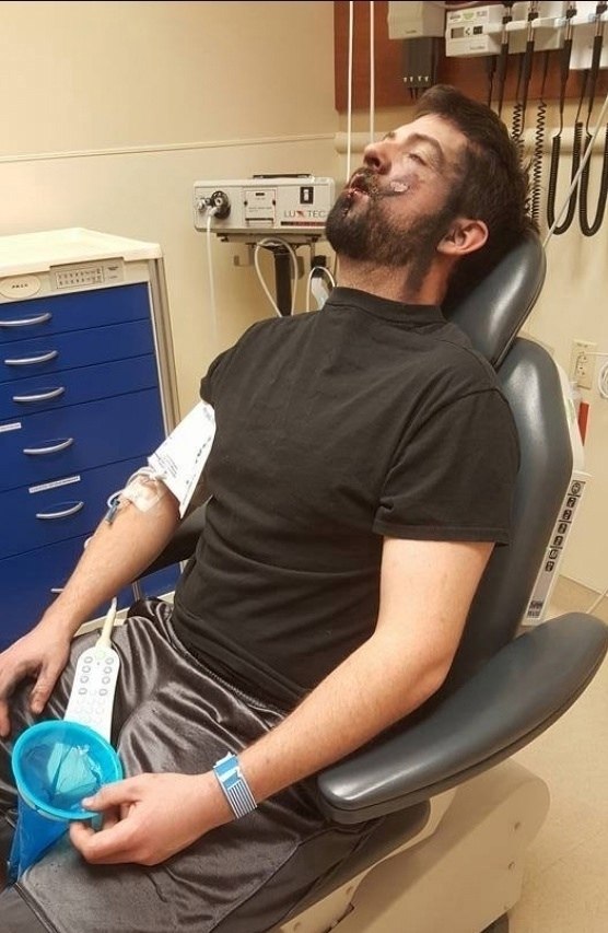 В Индии произошла ужасная трагедия: 28-летний мужчина скончался, когда у него в ухе взорвались ... - 3