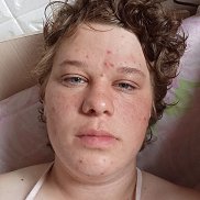 , 18 ,  