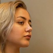 , 22 , 