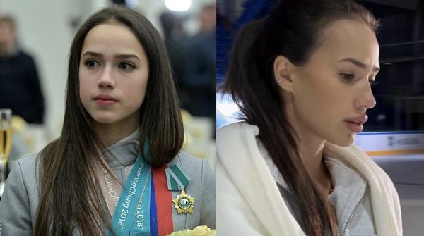Фигуристка Алина Загитова призналась, что увеличила губы.Олимпийская чемпионка по фигурному катанию ... - 3