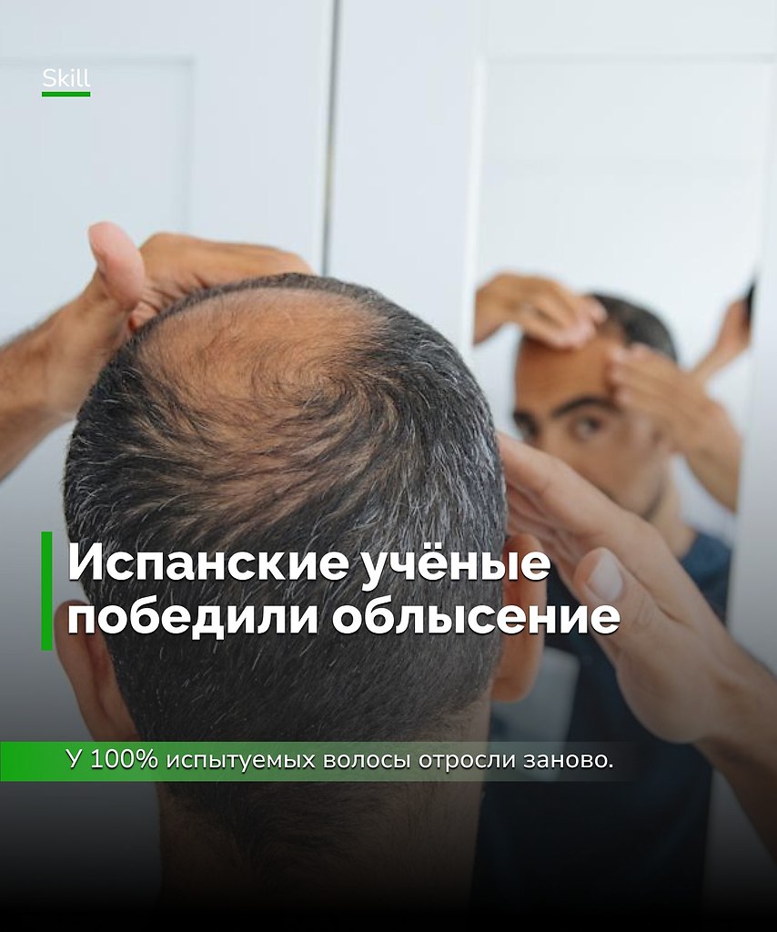 Испанские учёные сделали шаг к революции в лечении облысения — комбинация АТФ и стволовых клеток ...